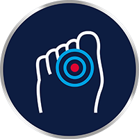 Mâncărimi și arsuri între degetele de la picioare?